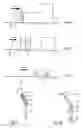 Fig. 03 - Method and device for protecting objects against rocket propelled grenades (RPGs)