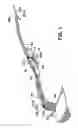 Fig. 02 - Anchor retrieval device, system and method