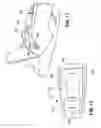 Fig. 08 - Anchor retrieval device, system and method