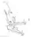 Fig. 06 - Collapsible locking slingshot