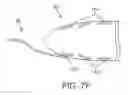 Fig. 08 - Automated tissue retention system