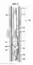 Fig. 03 - Methods and apparatuses for installing lateral wells