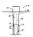 Fig. 01 - Anti-extrusion packer system
