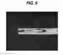 Fig. 07 - X-ray microscopy for characterizing hole shape and dimensions in surgical needles
