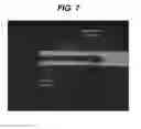 Fig. 08 - X-ray microscopy for characterizing hole shape and dimensions in surgical needles