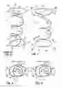 Fig. 03 - Coil spring having unknotted end turns with bumps