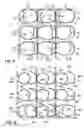 Fig. 06 - Coil spring having unknotted end turns with bumps