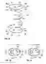 Fig. 09 - Coil spring having unknotted end turns with bumps