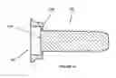 Fig. 11 - Retaining apparatus for a seal