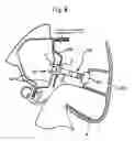 Fig. 10 - Clip for airbag