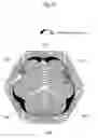 Fig. 24 - Coil device
