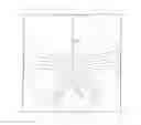 Fig. 01 - Method for providing a spectacle ophthalmic lens by calculating or selecting a design