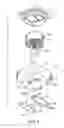 Fig. 02 - Electrolytic capacitor