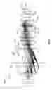 Fig. 03 - Multiple focus point light