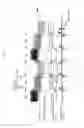 Fig. 06 - Noise suppression apparatus