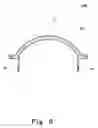 Fig. 07 - Diaphragm and speaker