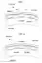 Fig. 06 - Rotary machine scroll structure and rotary machine