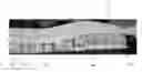 Fig. 01 - Linear peristaltic pump with fingers and membrane and finger for such a pump