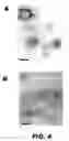 Fig. 07 - Ligand directed toroidal nanoparticles for therapy and diagnostic imaging