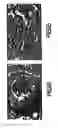 Fig. 08 - Compositions and Methods Related to Fructosamine-3-Kinase Inhibitors