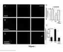 Fig. 02 - Methods for ameliorating and preventing central nervous system inflammation
