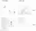 Fig. 01 - Wound healing compositions, systems, and methods