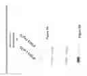 Fig. 06 - Genetic markers associated with interferon-alpha response