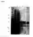 Fig. 06 - Bacteriophage preparations and methods of use thereof