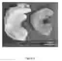 Fig. 04 - OSSEOINTEGRATIVE MENISCUS AND CARTILAGE IMPLANTS BASED ON BETA-GLUCAN NANOCOMPOSITES