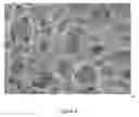 Fig. 05 - OSSEOINTEGRATIVE MENISCUS AND CARTILAGE IMPLANTS BASED ON BETA-GLUCAN NANOCOMPOSITES