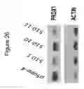 Fig. 32 - MicroRNA Diagnostics for Cancer