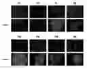 Fig. 01 - Compositions and Methods For Detecting Histamine Related Disorders