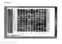 Fig. 07 - Gene expression signatures in enriched tumor cell samples