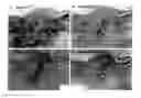 Fig. 01 - METHODS FOR ASSESSING THE RISK FOR DEVELOPMENT OF CARDIOVASCULAR DISEASE