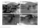 Fig. 04 - METHODS FOR ASSESSING THE RISK FOR DEVELOPMENT OF CARDIOVASCULAR DISEASE