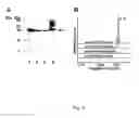 Fig. 05 - METHODS FOR ASSESSING THE RISK FOR DEVELOPMENT OF CARDIOVASCULAR DISEASE