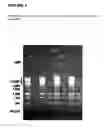 Fig. 02 - Methods and compositions for the extraction and amplification of nucleic acid from a sample