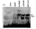 Fig. 07 - Adenoviruses, nucleic acids that code for the same and the use of said viruses