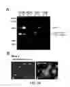 Fig. 35 - VECTORS WITH MODIFIED PROTEASE-DEPENDENT TROPISM