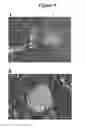 Fig. 08 - Novel Use of Liver X Receptor Agonists