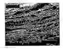 Fig. 01 - Nanofibrillar structure and applications including cell and tissue culture