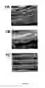 Fig. 02 - Nanofibrillar structure and applications including cell and tissue culture