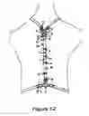 Fig. 07 - Halter bra