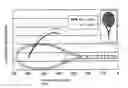 Fig. 01 - MULTIPLE STRING FOR A BALL GAME RACKET