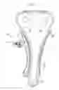 Fig. 02 - RATCHET-TYPE TENSIONER