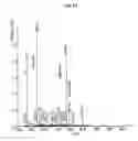 Fig. 02 - Continuous administration of dopa decarboxylase inhibitors and compositions for same
