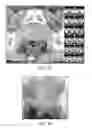 Fig. 06 - APPARATUSES AND TECHNIQUES FOR BIOACTIVE DRUG DELIVERY IN THE PROSTATE GLAND