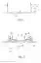 Fig. 03 - DEVICE AND METHOD FOR SUSPENDING AN ORGAN DURING SURGERY