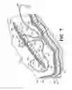 Fig. 05 - Methods for using self-retaining sutures in endoscopic procedures