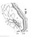 Fig. 07 - Methods for using self-retaining sutures in endoscopic procedures